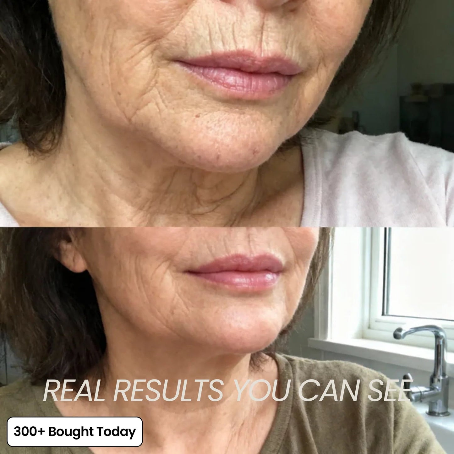 ✨LAST DAY 65% OFF MediCore Pink Collagen Volume Multi Balm🌸