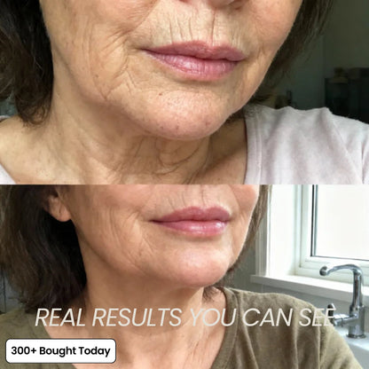 ✨LAST DAY 65% OFF MediCore Pink Collagen Volume Multi Balm🌸