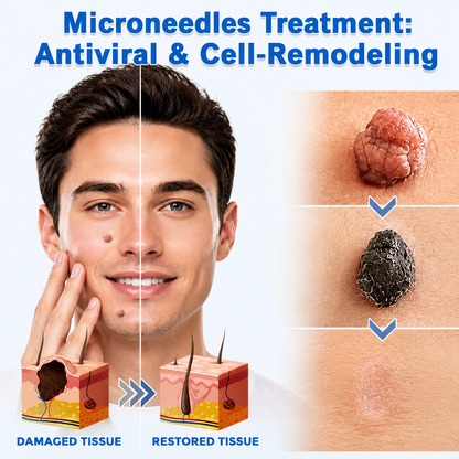 🔥Elmstr®2-in-1 Microneedle & Hydrocolloid Patch🍀| Removes Raised Moles, Acne, Flat Warts & Skin Tags | Helps Improve Wrinkles, Scars & Blemishes | Invisible Patches for Face & Body