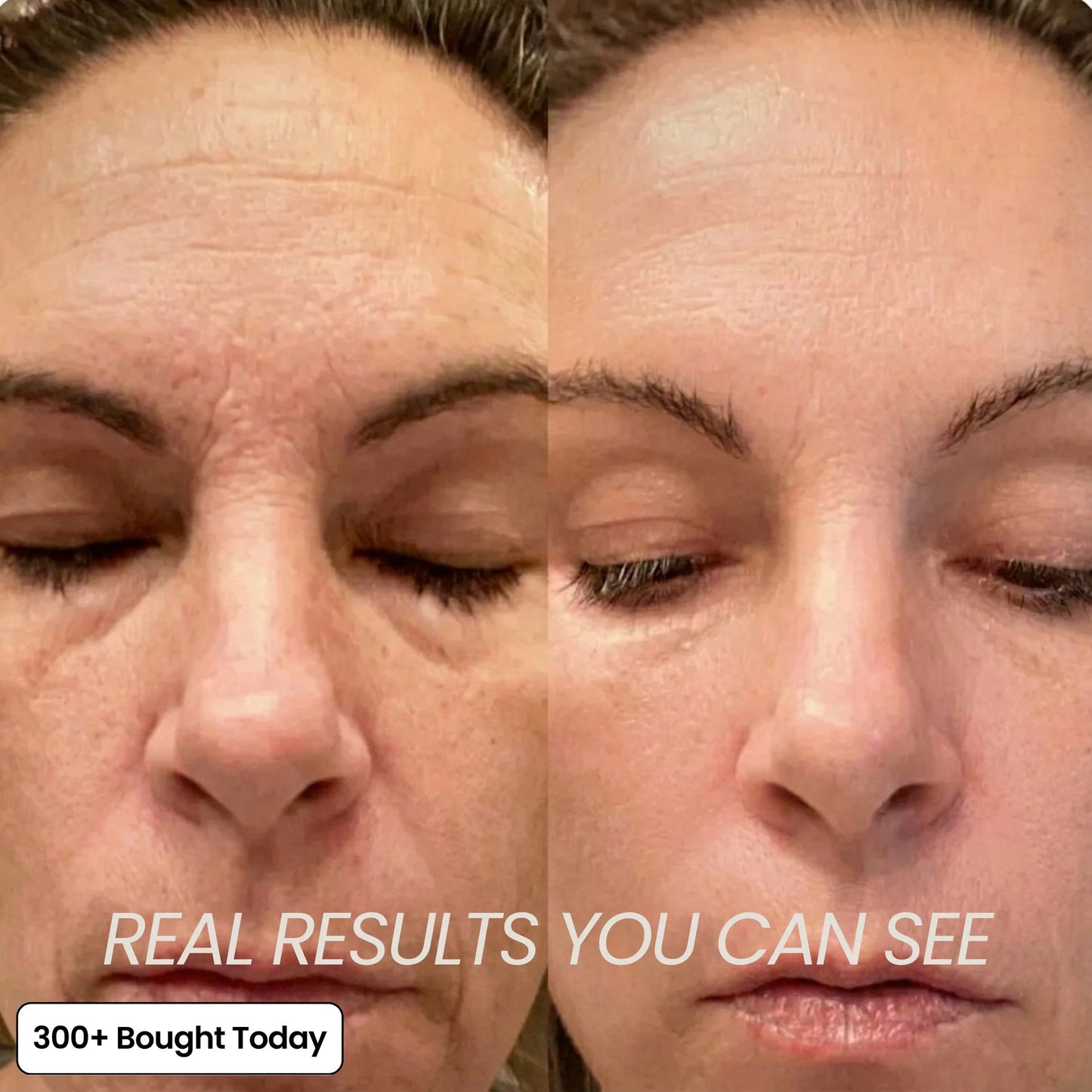 ✨LAST DAY 65% OFF MediCore Pink Collagen Volume Multi Balm🌸