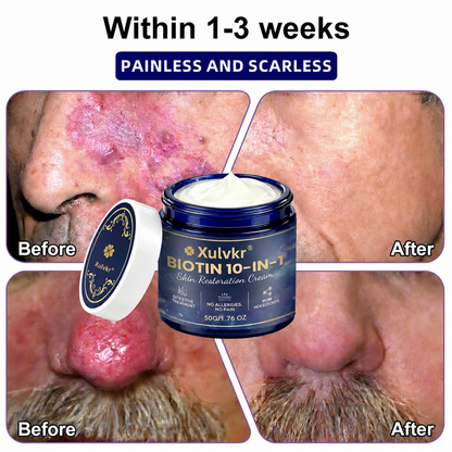 🍀 Xulvkr® Biotin 10-in-1 Skin Restoration Cream | Bigger 50g Jar, Upgraded Formula